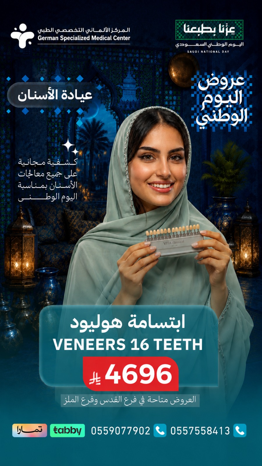 ابتسامة هوليود - Veneers 16 Teeth